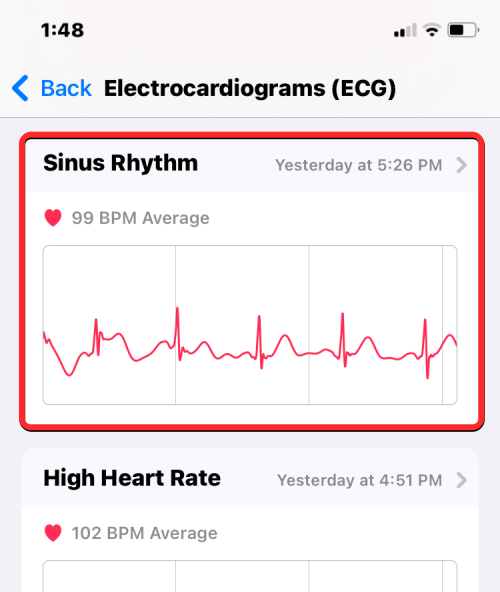 Zaznamenajte EKG na Apple Watch: Podrobný sprievodca