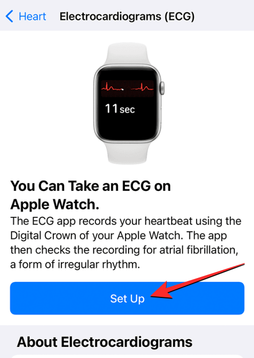 Zaznamenajte EKG na Apple Watch: Podrobný sprievodca