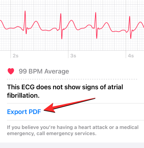 Rögzítse az EKG-t az Apple Watchon: lépésről lépésre