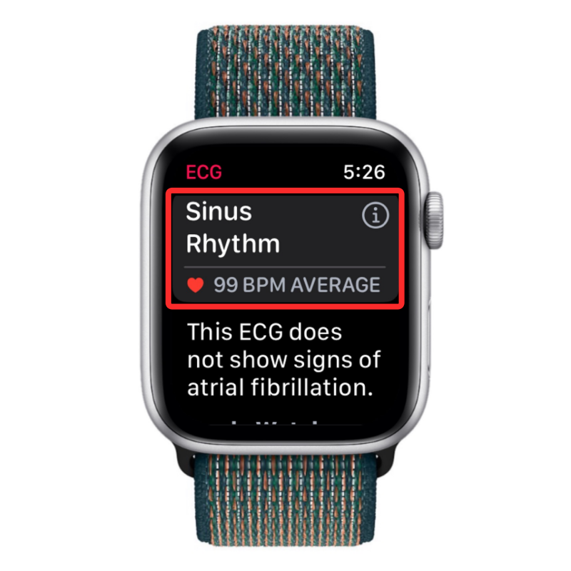 Tallenna EKG Apple Watchiin: Vaiheittainen opas
