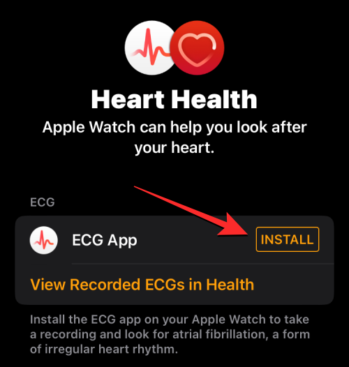 Tallenna EKG Apple Watchiin: Vaiheittainen opas