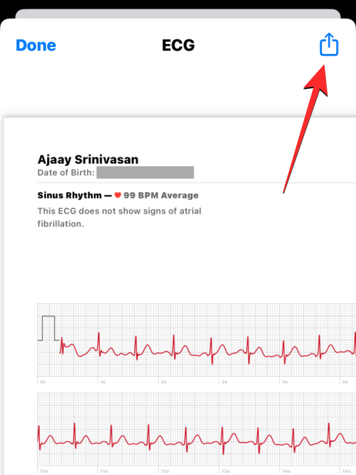 Rögzítse az EKG-t az Apple Watchon: lépésről lépésre