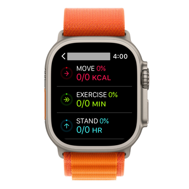 Del fitness på Apple Watch: Trin-for-trin guide