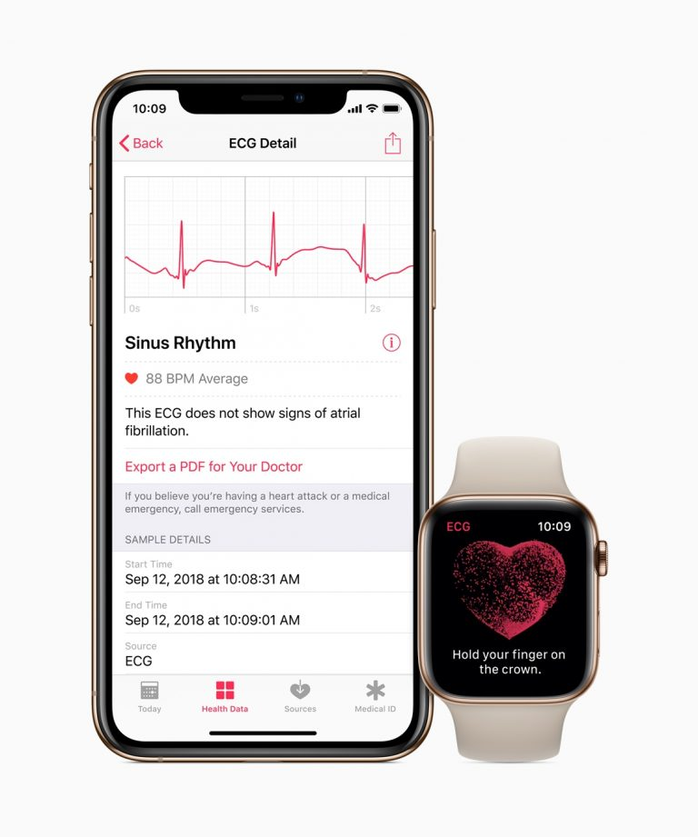 Slik bruker du EKG-appen på Apple Watch Series 4